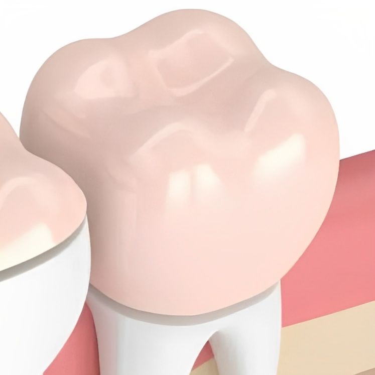 Dental Crowns