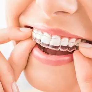 Invisalign